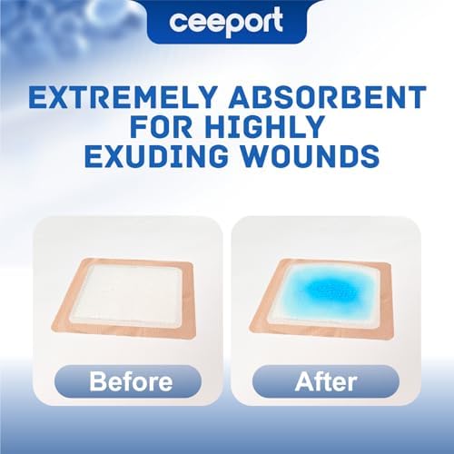 Silicone Super Absorbent Wound Dressing 5" x 5", 10 Individual Pack