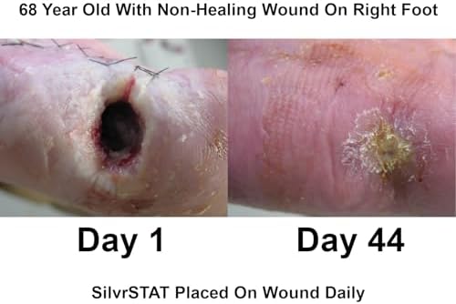 First Aid Kit Gel, 32 PPM Silver Healing Wound Dressing Gel, SilverSol Ag₄O₄ Particles, 1 oz