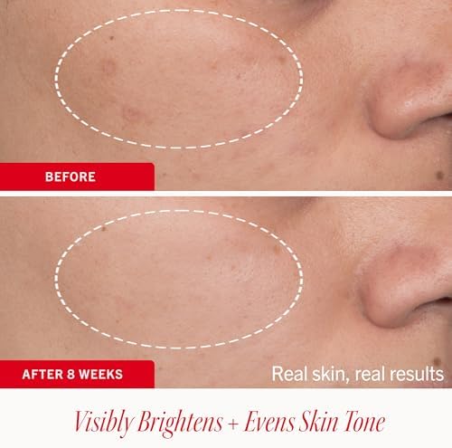 First Aid Beauty Brighten + Glow Dark Spot Serum with Niacinamide, 1 oz