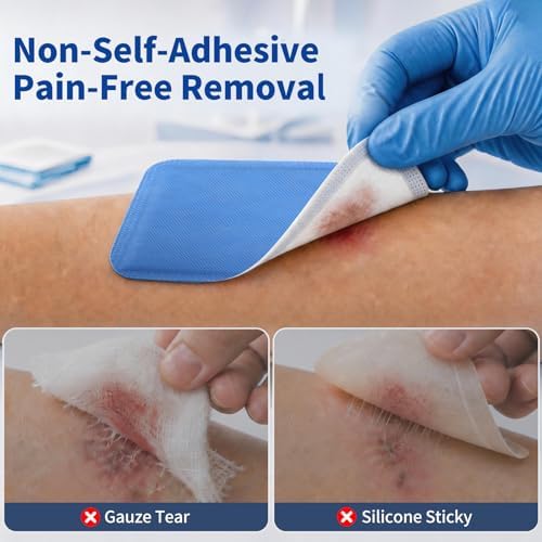 5x5 Extra Large Super Absorbent Wound Dressing, 10 Pack - Ultrasorb Polymer Non-Adherent Pads for Bed Sores, Pressure Ulcers, Abdominal Wounds - High Capacity for Heavy Exudate