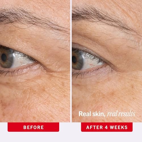 First Aid Beauty Ultra Repair Retinol Eye Cream with Ceramides