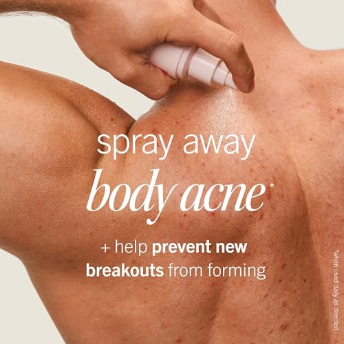 First Aid Beauty Body Acne Spray, 2% Salicylic Acid, 3 oz