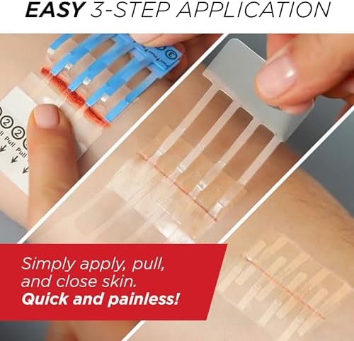 Emergency Laceration Closures - Repair Wounds Without Stitches, Skin Closure Device for 3 Individual Wounds Or Combine for Total Length of 4 1/4 Inches