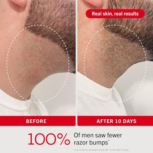 First Aid Beauty Ingrown Hair Pads for Men, Razor Bump Aftershave, 60 Ct