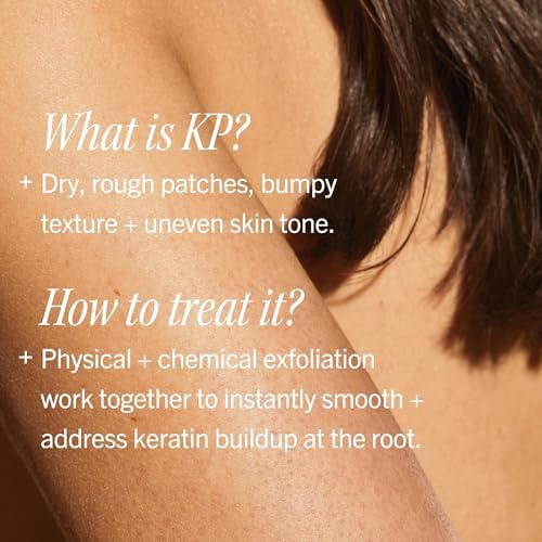 First Aid Beauty KP Bump Eraser Body Scrub, 10% AHA Body Exfoliator