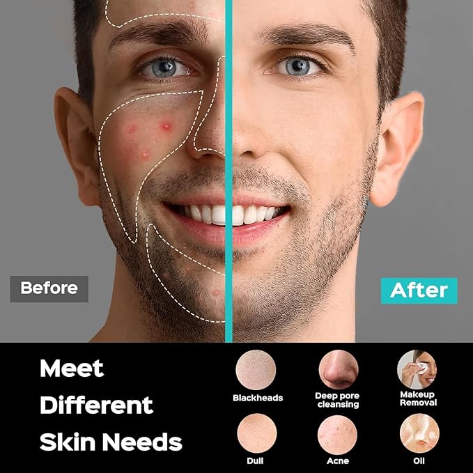 COSLUS FBS01 Face Scrubber Facial Cleansing Brush: 5 Cleansing Modes Silicone Face Wash Scrubber for Men Beard Care, Sensitive Skin - Deep Cleansing & Gentle Exfoliating, Portable for Shower & Travel